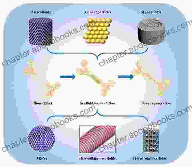 Nanotechnology Based Bone Implants With Controlled Release Of Antibiotics, Effectively Combating Bone Infections And Promoting Bone Regeneration Nanotechnology In Skin Soft Tissue And Bone Infections