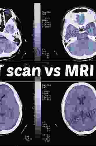 Intraoperative Ultrasound Imaging In Neurosurgery: Comparison With CT And MRI