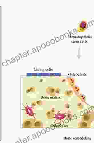 Stem Cells And Bone Tissue